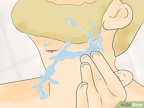 Image titled Shave Your Neck when Growing a Beard Step 10