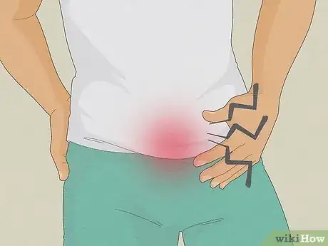 Image titled Know if You Have Epididymitis Step 2