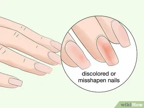 Image titled Strengthen Weak Fingernails Naturally Step 15