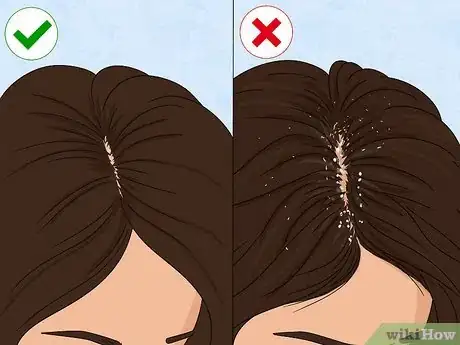 Image titled How Often Should You Wash Short Hair Step 9