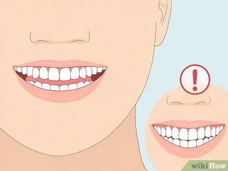 Image titled Have the Perfect Smile Step 1