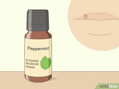 Image titled Treat Cold Sores with Essential Oils Step 2