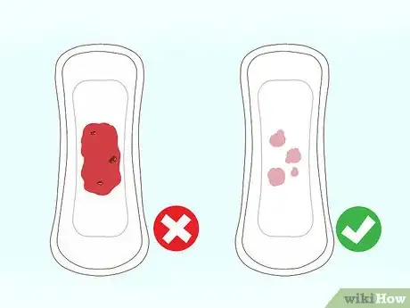 Image titled Recognize Implantation Bleeding Step 3