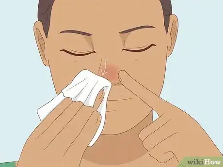 Image titled Clear Nasal Congestion Step 1