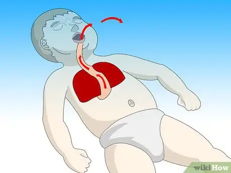 Image titled Do First Aid on a Choking Baby Step 8