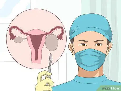 Image titled Shrink Ovarian Cysts Step 8