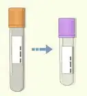 Troubleshoot a Difficult Venipuncture