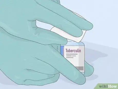 Image titled Properly Place a TB Skin Test Step 10