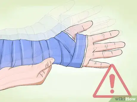 Image titled Manage a Broken Arm Step 17