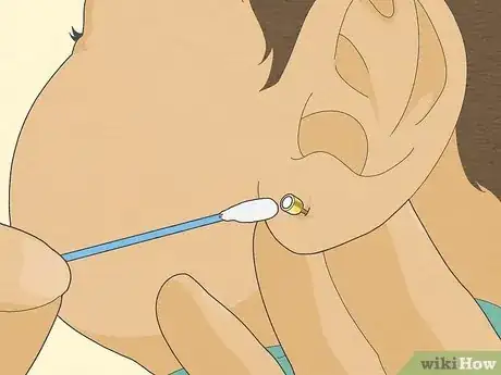 Image titled When to Pierce Baby Ears Step 8