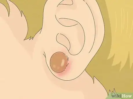 Image titled When to Pierce Baby Ears Step 4