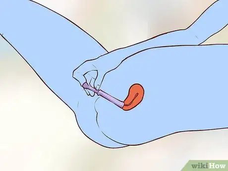 Image titled Insert Vaginal Suppositories Step 5