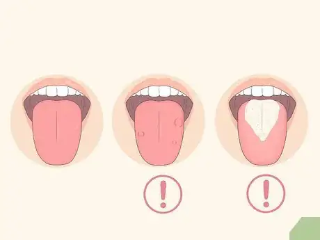 Image titled Clean Your Tongue Properly Step 1