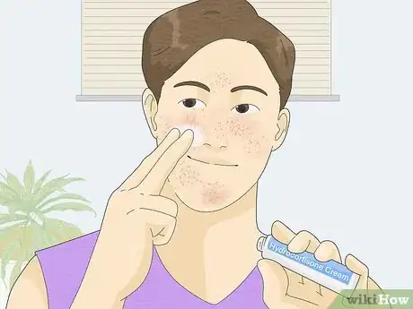 Image titled Treat Face Eczema Step 9