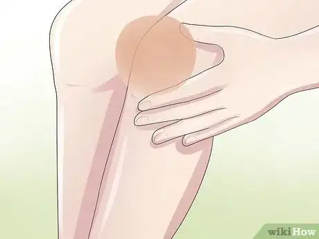 Image titled Know if You Have a Baker's Cyst Step 1