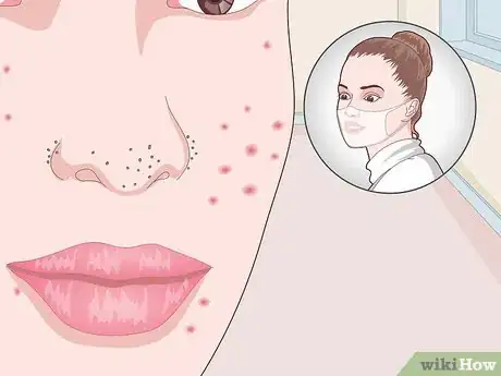 Image titled Reduce Oil from Your Face Naturally Step 11