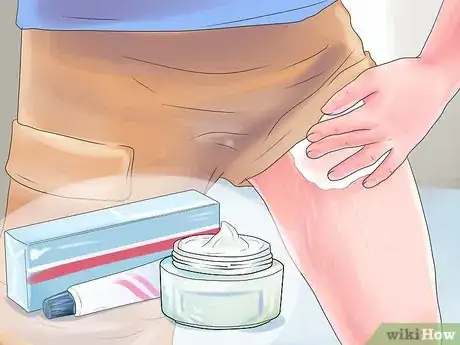 Image titled Get Rid of Stretch Marks Step 5