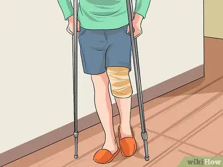 Image titled Manage Pain After Knee Replacement Surgery Step 3