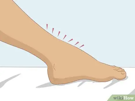 Image titled Know if You Have a Pinched Nerve Step 2