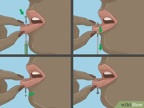 Image titled Pierce Snakebites Step 6