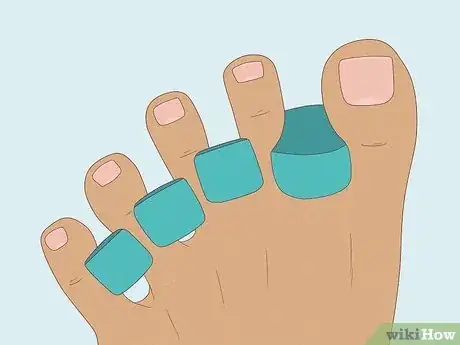 Image titled Do a French Pedicure Step 4