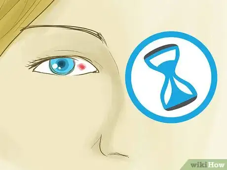 Image titled Get Rid of a Red Eye Step 5