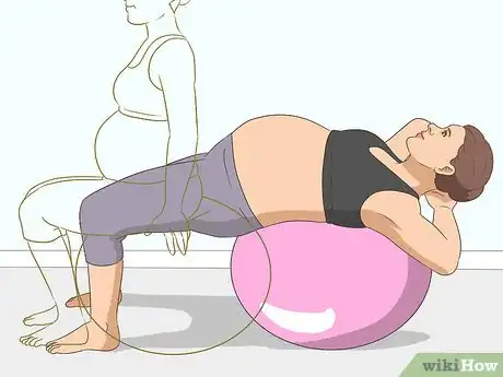 Image titled Prevent Diastasis Recti Step 7