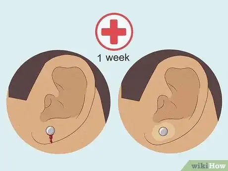 Image titled Reduce Pain Caused by a New Piercing Step 16