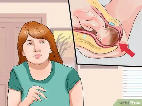 Image titled Care for an Episiotomy Postpartum Step 14