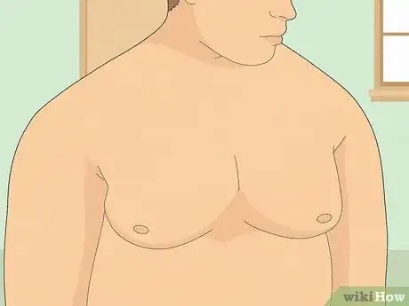 Image titled Detect Gynecomastia Step 12