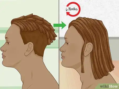 Image titled Dreadlock Any Hair Type Without Products Step 1