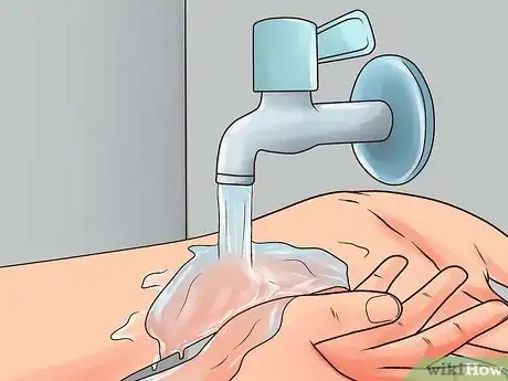 Image titled Avoid a Stomach Virus After Being Exposed Step 10