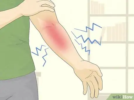 Image titled Know if Left Arm Pain Is Heart Related Step 10