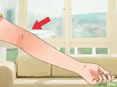 Image titled Check for a Fracture when Performing First Aid Step 1