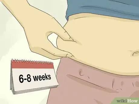 Image titled Reduce Your Belly After a C Section Step 1