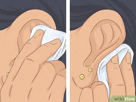 Image titled Is It Safe to Pierce Your Own Cartilage Step 12