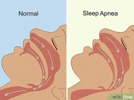 Image titled What Excessive Yawning Might Mean Step 10