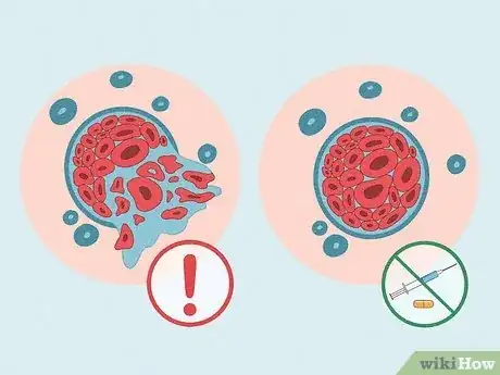 Image titled Treat Tumors in Hamsters Step 6