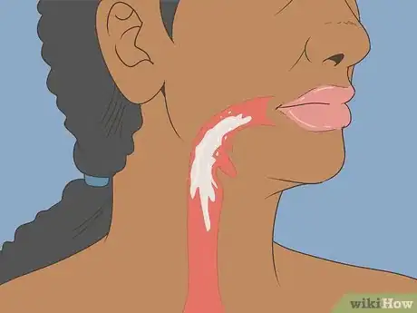 Image titled Wear Dentures Step 10