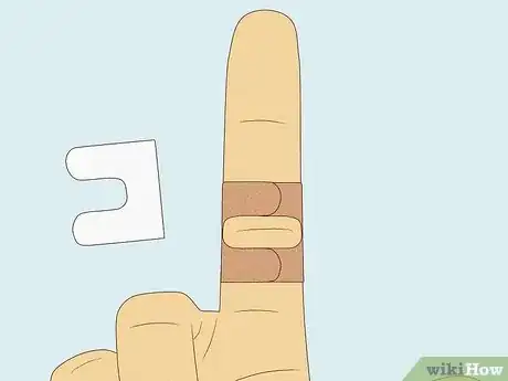 Image titled Apply Different Types of Bandages Step 12