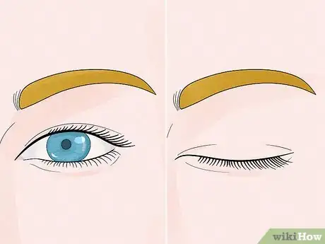 Image titled Put on Contact Lenses with Long Nails Step 5