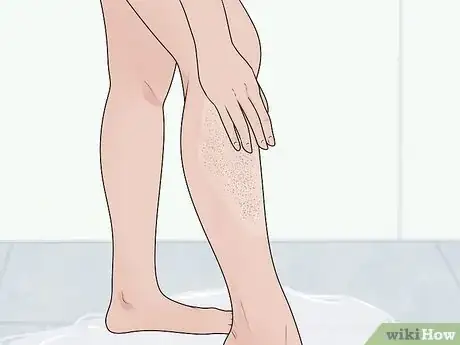 Image titled Remove an Ingrown Hair Step 4