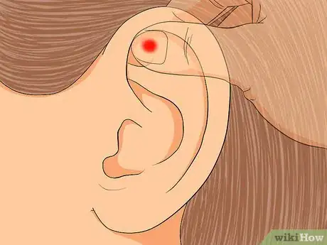 Image titled Apply Reflexology to the Ears Step 6