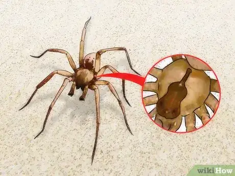 Image titled Identify and Treat Recluse (Fiddleback) Spider Bites Step 1