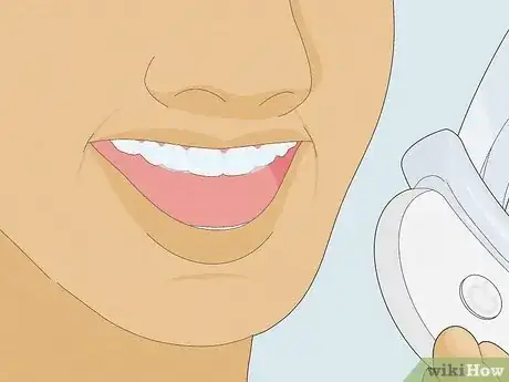 Image titled Use the LED Light to Whiten Teeth with Whitening Trays Step 7