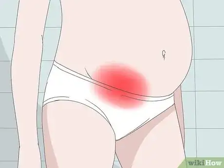 Image titled Relieve Pelvic Pain During Pregnancy Step 1