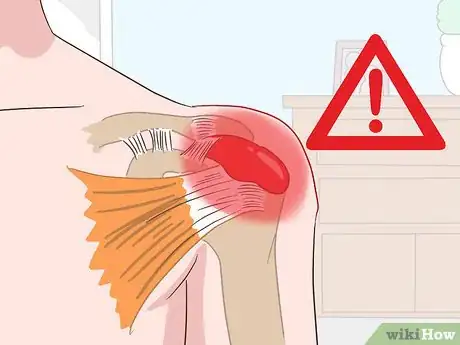 Image titled Diagnose Shoulder Pain Step 3