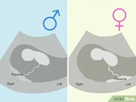 Image titled Tell if You're Pregnant with a Girl or Boy Step 26