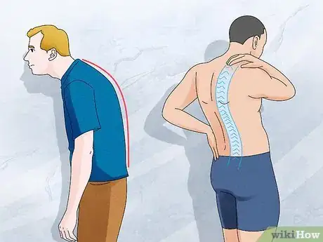 Image titled Avoid Kyphosis Step 6