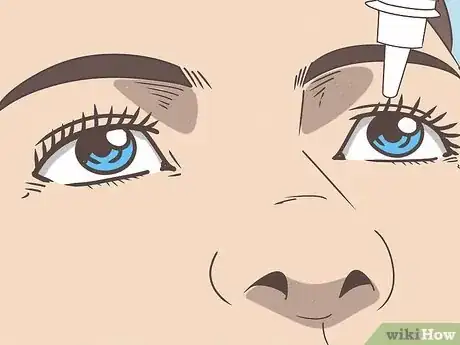 Image titled Remove Contact Lenses with Cotton Swabs Step 3